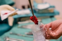Surgical Oncology - ARHI Hospital